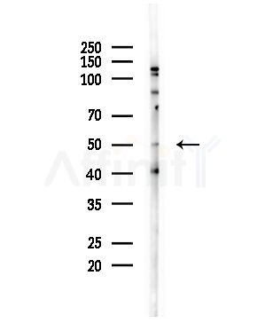 MEF2C Antibody - Western blot analysis of lysates from HepG2 cells, using MEF2C Antibody at 1/1000 dilution.