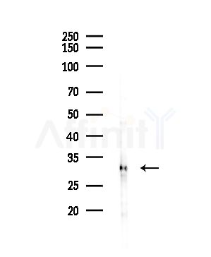 VDAC2 Antibody - Western blot analysis of lysates from COLO205 cells(UV,30min treatment), using VDAC2 Antibody at 1/1000 dilution.