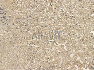 TXNRD2 Antibody - AF5399 at 1/100 staining human normal liver tissue by IHC-P.