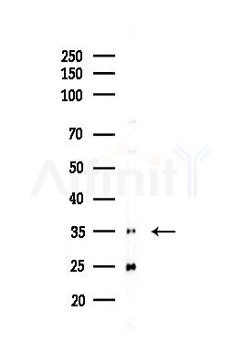 Cyclin H Antibody - Western blot analysis of lysates from HUVEC cells(UV,30min treatment), using Cyclin H Antibody at 1/1000 dilution.
