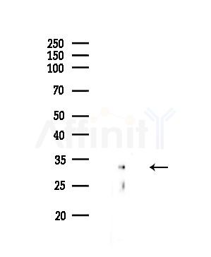 Cyclin D2 Antibody - Western blot analysis of lysates from COLO205 cells, using Cyclin D2 Antibody at 1/1000 dilution.