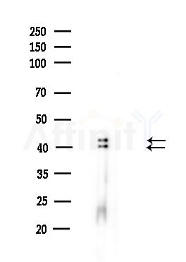 hnRPD Antibody - Western blot analysis of lysates from HUVEC cells(UV,30min treatment), using hnRPD Antibody at 1/1000 dilution.