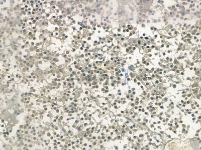 hnRPD Antibody - AF5419 at 1/100 staining human pituitary adenoma by IHC-P.