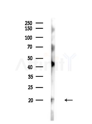 Phospho-CD3 zeta (Tyr142) Antibody - Western blot analysis of lysates from MCF7 cells(heat-shock,45min treatment), using Phospho-CD3 zeta (Tyr142) Antibody at 1/1000 dilution.
