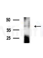 Phospho-IKK gamma (Ser85) Antibody - Western blot analysis of lysates from A375 cells(heat-shock,45min treatment), using Phospho-IKK gamma (Ser85) Antibody at 1/1000 dilution.