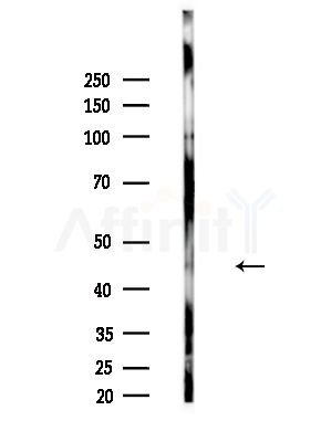 Phospho-IKK gamma (Ser85) Antibody - Western blot analysis of lysates from A375 cells(heat-shock,45min treatment), using Phospho-IKK gamma (Ser85) Antibody at 1/1000 dilution.