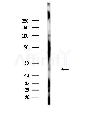 Phospho-IKK gamma (Ser85) Antibody - Western blot analysis of lysates from A375 cells(heat-shock,45min treatment), using Phospho-IKK gamma (Ser85) Antibody at 1/1000 dilution.