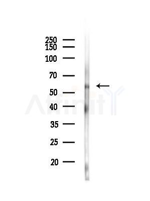 Phospho-Lck (Ser59) Antibody - Western blot analysis of lysates from Rat liver, using Phospho-Lck (Ser59) Antibody at 1/1000 dilution.