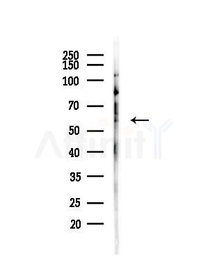 Phospho-Lck (Ser59) Antibody - Western blot analysis of lysates from A375 cells(heat-shock,45min treatment), using Phospho-Lck (Ser59) Antibody at 1/1000 dilution.