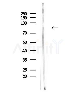 Phospho-ATRIP (Ser224) Antibody - Western blot analysis of lysates from Hela cells(UV,30min treatment), using Phospho-ATRIP (Ser224) Antibody at 1/1000 dilution.