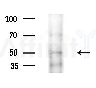 MMP8 Antibody - Western blot analysis of extracts from A375 cells(heat-shock,45min treatment), using MMP8 Antibody at 1/1000 dilution.