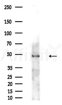 MMP8 Antibody - Western blot analysis of extracts from Mouse brain, using MMP8 Antibody at 1/1000 dilution.