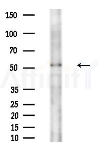 MMP8 Antibody - Western blot analysis of extracts from Rat liver, using MMP8 Antibody at 1/1000 dilution.