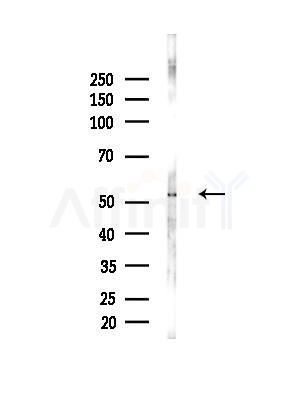 MMP8 Antibody - Western blot analysis of lysates from Rat liver, using MMP8 Antibody at 1/1000 dilution.