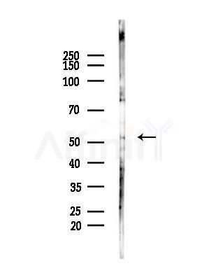 MMP8 Antibody - Western blot analysis of lysates from A375 cells(heat-shock,45min treatment), using MMP8 Antibody at 1/1000 dilution.