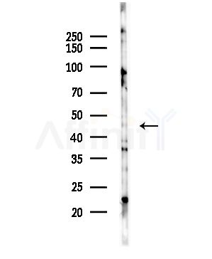5HT1A Receptor Antibody - Western blot analysis of lysates from COLO205 cells(UV,30min treatment), using 5HT1A Receptor Antibody at 1/1000 dilution.