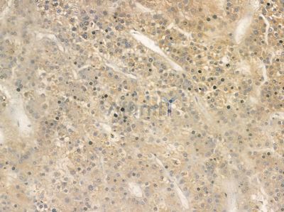GluR2/3 Antibody - AF5458 at 1/100 staining rat lung tissue by IHC-P.