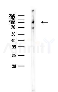 GluR2/3 Antibody - Western blot analysis of lysates from Mouse liver, using GluR2/3 Antibody at 1/1000 dilution.