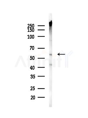 GLUT3 Antibody - Western blot analysis of lysates from COLO205 cells(heat-shock,45min treatment), using GLUT3 Antibody at 1/1000 dilution.