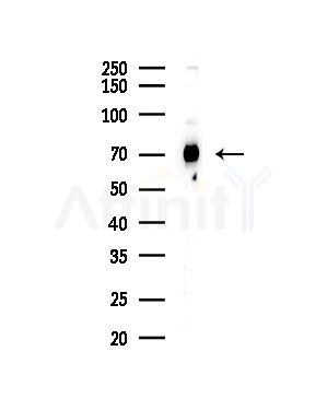 Grp75 Antibody - Western blot analysis of lysates from COLO205 cells(UV,30min treatment), using Grp75 Antibody at 1/1000 dilution.