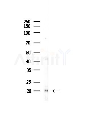COX IV Antibody - Western blot analysis of lysates from Hela cells(heat-shock,45min treatment), using COX IV Antibody at 1/1000 dilution.