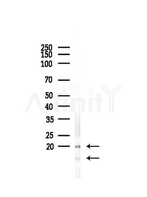 COX IV Antibody - Western blot analysis of lysates from Rat brain, using COX IV Antibody at 1/1000 dilution.