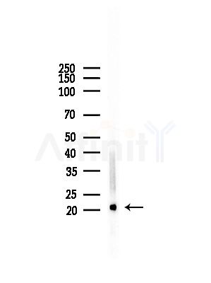 RhoH Antibody - Western blot analysis of lysates from Rat brain, using RhoH Antibody at 1/1000 dilution.
