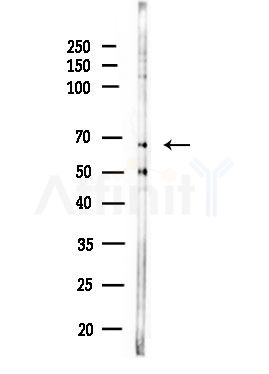 HDAC10 Antibody - Western blot analysis of lysates from Rat testis, using HDAC10 Antibody at 1/1000 dilution.