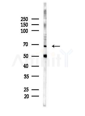 HDAC10 Antibody - Western blot analysis of lysates from Mouse brain, using HDAC10 Antibody at 1/1000 dilution.
