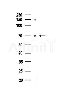 HDAC10 Antibody - Western blot analysis of lysates from HUVEC cells(UV,30min treatment), using HDAC10 Antibody at 1/1000 dilution.