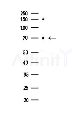 HDAC10 Antibody - Western blot analysis of lysates from Hela cells(starvation,24h treatment), using HDAC10 Antibody at 1/1000 dilution.