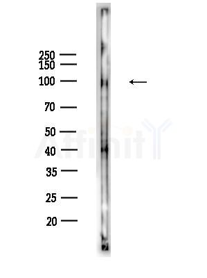 HDAC7 Antibody - Western blot analysis of lysates from HepG2 cells(heat-shock,45min treatment), using HDAC7 Antibody at 1/1000 dilution.