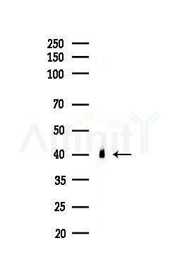 TBP Antibody - Western blot analysis of lysates from HUVEC cells(UV,30min treatment), using TBP Antibody at 1/1000 dilution.