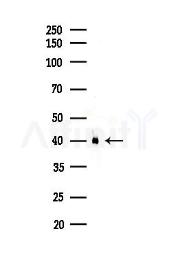 TBP Antibody - Western blot analysis of lysates from Hela cells(starvation,24h treatment), using TBP Antibody at 1/1000 dilution.
