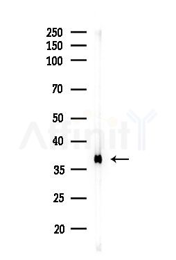 TBP Antibody - Western blot analysis of lysates from Rat testis, using TBP Antibody at 1/1000 dilution.
