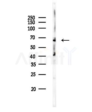 Cytokeratin 16 Antibody - Western blot analysis of lysates from Rat brain, using Cytokeratin 16 Antibody at 1/1000 dilution.