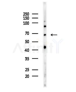 Cytokeratin 16 Antibody - Western blot analysis of lysates from HepG2 cells, using Cytokeratin 16 Antibody at 1/1000 dilution.