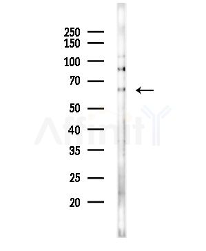 Cytokeratin 16 Antibody - Western blot analysis of lysates from COLO205 cells(UV,30min treatment), using Cytokeratin 16 Antibody at 1/1000 dilution.
