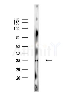 TSG6 Antibody - Western blot analysis of lysates from HepG2 cells(heat-shock,45min treatment), using TSG6 Antibody at 1/1000 dilution.