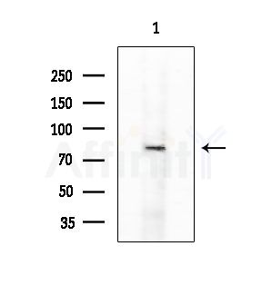 IKK alpha/ beta Antibody - Western blot analysis of extracts from Rat testis, using IKK alpha/ beta Antibody at 1/1000 dilution.