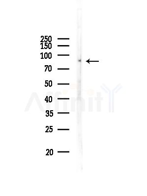 IKK alpha/ beta Antibody - Western blot analysis of lysates from Rat testis, using IKK alpha/ beta Antibody at 1/1000 dilution.