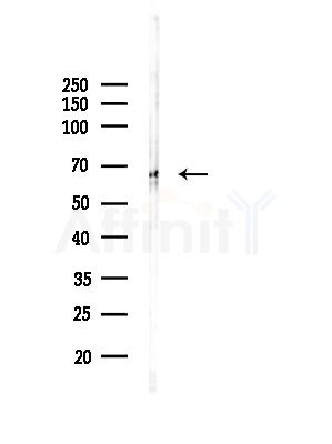 PDPK1 Antibody - Western blot analysis of lysates from A375 cells(LPS, 4h treatment), using PDPK1 Antibody at 1/1000 dilution.