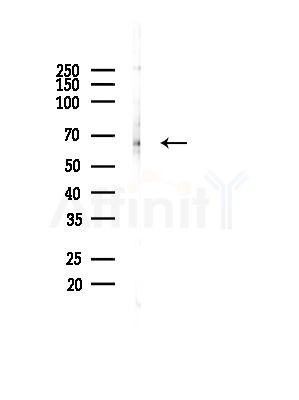 PDPK1 Antibody - Western blot analysis of lysates from Rat brain, using PDPK1 Antibody at 1/1000 dilution.