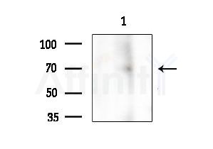 TAK1 Antibody - Western blot analysis of extracts from COLO205 cells, using TAK1 Antibody at 1/1000 dilution.
