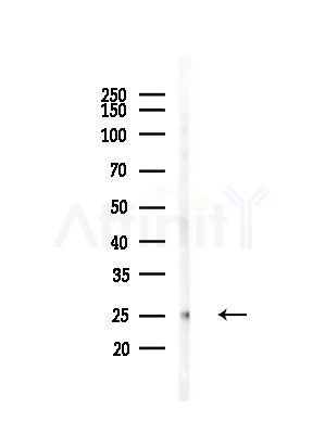 Thymidine Kinase 1/TK1 Antibody - Western blot analysis of lysates from COLO205 cells(heat-shock,45min treatment), using Thymidine Kinase 1/TK1 Antibody at 1/1000 dilution.