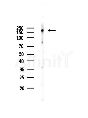 HER2/ErbB2 Antibody - Western blot analysis of lysates from HUVEC cells, using HER2/ErbB2 Antibody at 1/1000 dilution.