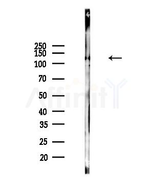 Integrin beta3 Antibody - Western blot analysis of lysates from Hela cells(heat-shock,45min treatment), using Integrin beta3 Antibody at 1/1000 dilution.