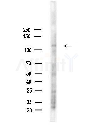 ATP1A1 Antibody - Western blot analysis of lysates from LoVo cells(heat-shock, 45min treatment), using ATP1A1 Antibody at 1/1000 dilution.