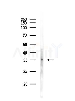 hnRNP C1/C2 Antibody - Western blot analysis of lysates from RAW264.
