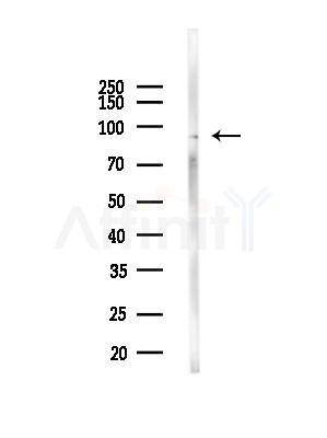 SP1 Antibody - Western blot analysis of lysates from EC304 cells(heat-shock,45min treatment), using SP1 Antibody at 1/1000 dilution.